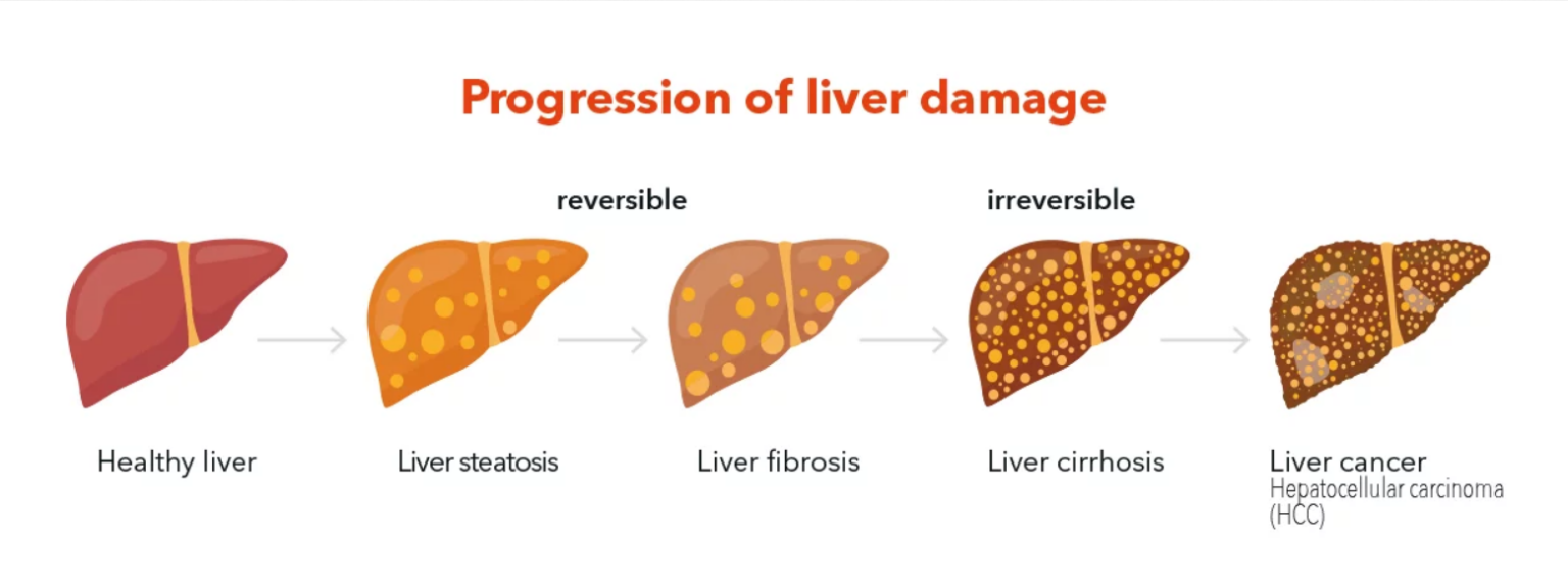 Fibroscan – Diagnostic Outpatient Imaging